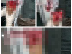 Tragis ! Karyawan PT TRI EXCELLA HARMONY Mengalami Kecelakaan Hingga Cacat Permanen