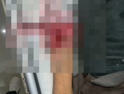 Terjepit Mesin Pabrik PT. Tri Excella Harmony, Jari Tangan Seorang Buruh Terancam Cacat Permanen